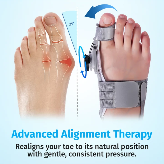 Bunion Corrector